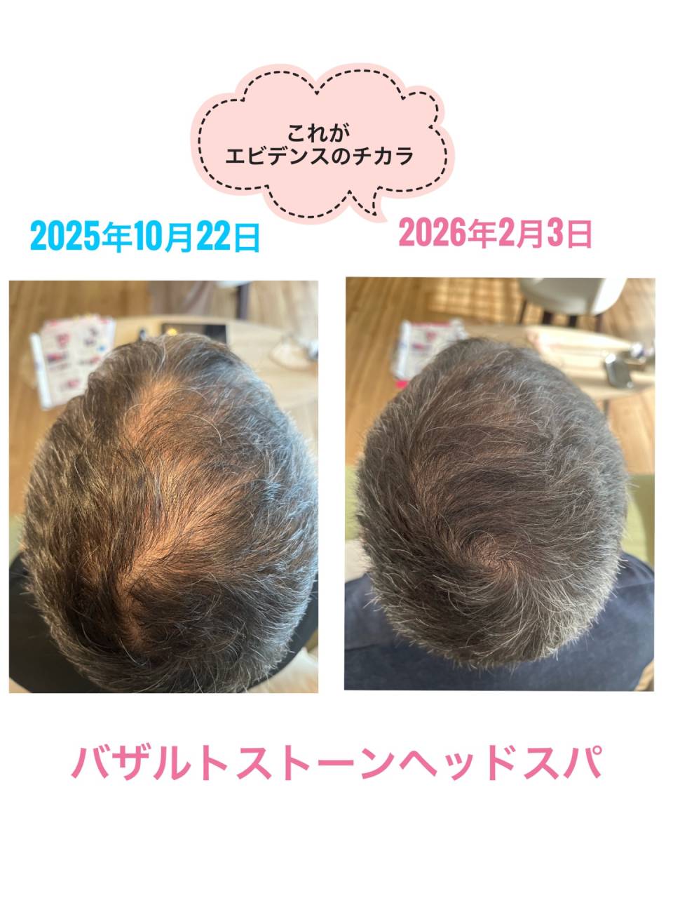 宇都宮　育毛　ヘッドスパ　エビデンスあり