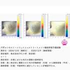 【宇都宮　バザルトストーン　フェイシャル　毛穴縮小エビデンス】