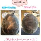 宇都宮　育毛　ヘッドスパ　エビデンスあり